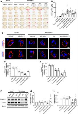 QiShenYiQi Inhibits Tissue Plasminogen Activator–Induced Brain Edema and Hemorrhage after Ischemic Stroke in Mice